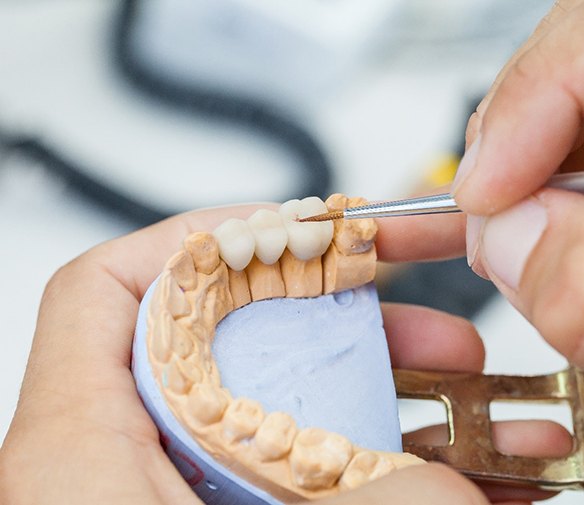 Dental technician working on dental crowns in Flint